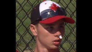 ワールドカップ 男子ソフトボール オーストラリア v カナダ 【World Cup】【Men’s softball】 Australia vs Canada u-18 ソフトボール 平林金属